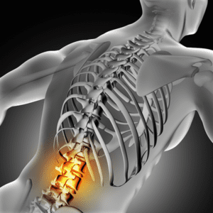 sciatic pain