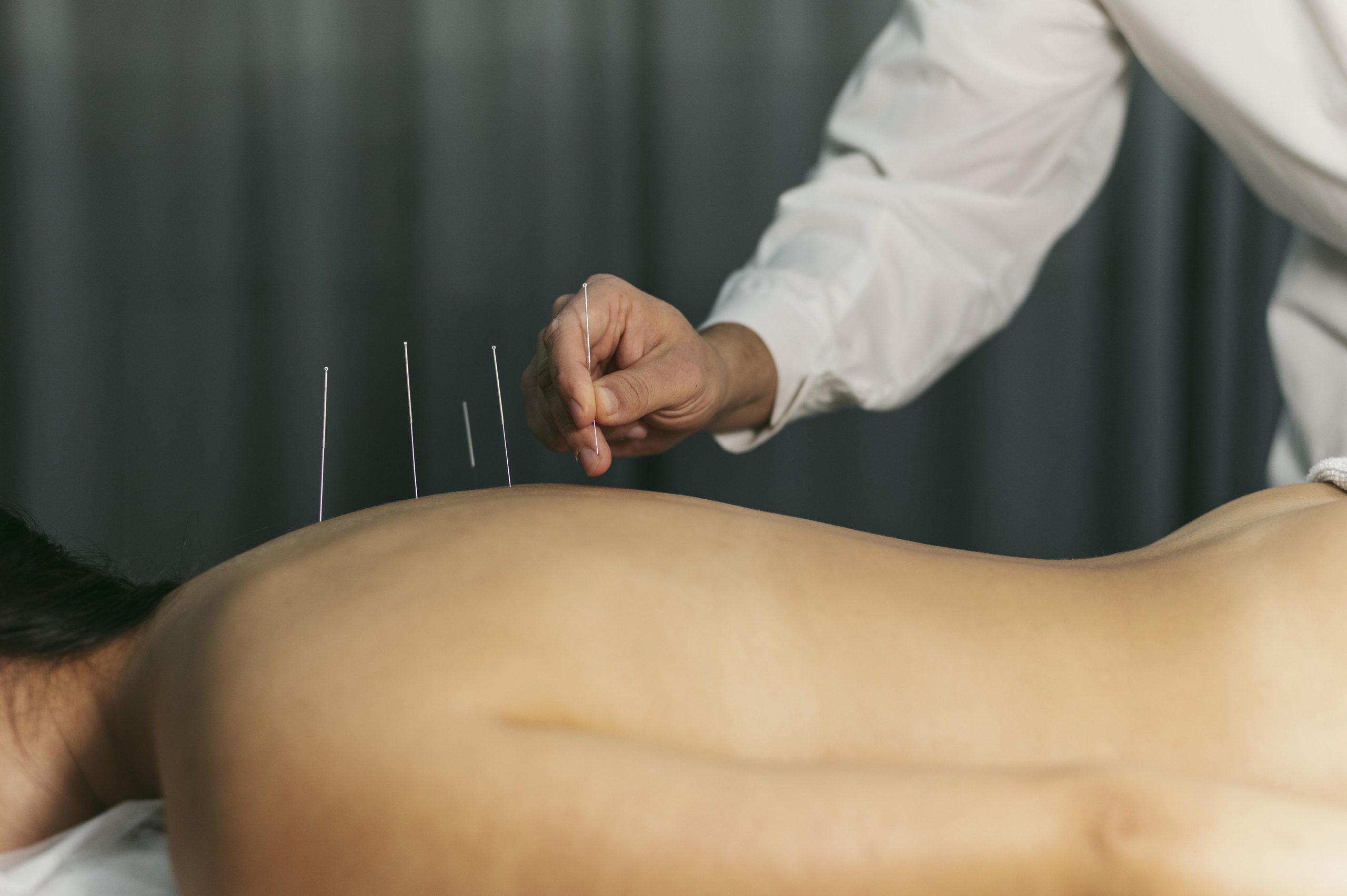 Dry Needling Cincinnati
