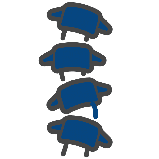 Degenerative Disc Disease icon