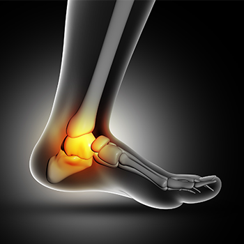 ankle-pain